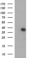 MCAT Antibody - HEK293T cells were transfected with the pCMV6-ENTRY control (Left lane) or pCMV6-ENTRY MCAT (Right lane) cDNA for 48 hrs and lysed. Equivalent amounts of cell lysates (5 ug per lane) were separated by SDS-PAGE and immunoblotted with anti-MCAT.