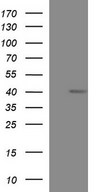 MCAT Antibody - HEK293T cells were transfected with the pCMV6-ENTRY control (Left lane) or pCMV6-ENTRY MCAT (Right lane) cDNA for 48 hrs and lysed. Equivalent amounts of cell lysates (5 ug per lane) were separated by SDS-PAGE and immunoblotted with anti-MCAT.