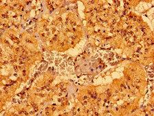 MCAT Antibody - Immunohistochemistry image of paraffin-embedded human adrenal gland tissue at a dilution of 1:100
