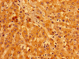 MCAT Antibody - Immunohistochemistry image of paraffin-embedded human liver tissue at a dilution of 1:100