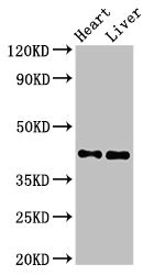 MCAT Antibody - Positive Western Blot detected in Rat heart tissue, Mouse liver tissue. All lanes: MCAT antibody at 2.5 µg/ml Secondary Goat polyclonal to rabbit IgG at 1/50000 dilution. Predicted band size: 43, 20 KDa. Observed band size: 43 KDa