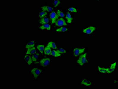 MCC Antibody - Immunofluorescence staining of Hela cells diluted at 1:166, counter-stained with DAPI. The cells were fixed in 4% formaldehyde, permeabilized using 0.2% Triton X-100 and blocked in 10% normal Goat Serum. The cells were then incubated with the antibody overnight at 4°C.The Secondary antibody was Alexa Fluor 488-congugated AffiniPure Goat Anti-Rabbit IgG (H+L).