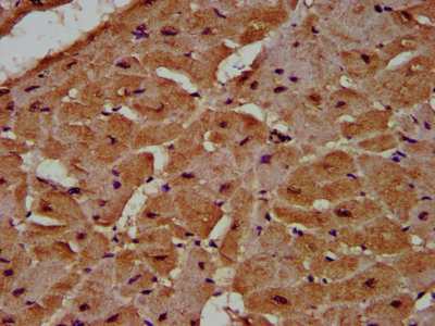 MCC Antibody - Immunohistochemistry Dilution at 1:500 and staining in paraffin-embedded human heart tissue performed on a Leica BondTM system. After dewaxing and hydration, antigen retrieval was mediated by high pressure in a citrate buffer (pH 6.0). Section was blocked with 10% normal Goat serum 30min at RT. Then primary antibody (1% BSA) was incubated at 4°C overnight. The primary is detected by a biotinylated Secondary antibody and visualized using an HRP conjugated SP system.