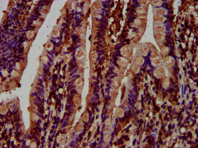 MCC Antibody - Immunohistochemistry Dilution at 1:500 and staining in paraffin-embedded human small intestine tissue performed on a Leica BondTM system. After dewaxing and hydration, antigen retrieval was mediated by high pressure in a citrate buffer (pH 6.0). Section was blocked with 10% normal Goat serum 30min at RT. Then primary antibody (1% BSA) was incubated at 4°C overnight. The primary is detected by a biotinylated Secondary antibody and visualized using an HRP conjugated SP system.