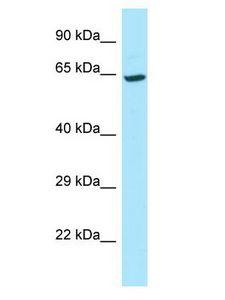 MCCC1 Antibody - MCCC1 antibody Western Blot of Jurkat. Antibody dilution: 1 ug/ml.  This image was taken for the unconjugated form of this product. Other forms have not been tested.