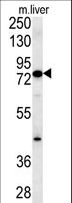MCCC1 Antibody - MCCC1 Antibody western blot of mouse liver tissue lysates (15 ug/lane). The MCCC1 antibody detected MCCC1 protein (arrow).