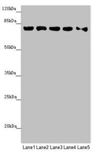 MCCC1 Antibody - Western blot All Lanes: MCCC1 antibody at 0.89 ug/ml Lane 1: HepG-2 whole cell lysate Lane 2: 293T whole cell lysate Lane 3: Hela whole cell lysate Lane 4: MCF7 whole cell lysate Lane 5: A549 whole cell lysate Secondary Goat polyclonal to rabbit IgG at 1/10000 dilution Predicted band size: 80 kDa Observed band size: 80 kDa