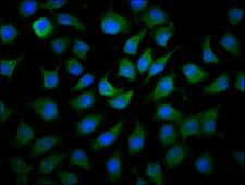 MCCC1 Antibody - Immunofluorescence staining of A549 cells diluted at 1:166, counter-stained with DAPI. The cells were fixed in 4% formaldehyde, permeabilized using 0.2% Triton X-100 and blocked in 10% normal Goat Serum. The cells were then incubated with the antibody overnight at 4°C.The Secondary antibody was Alexa Fluor 488-congugated AffiniPure Goat Anti-Rabbit IgG (H+L).