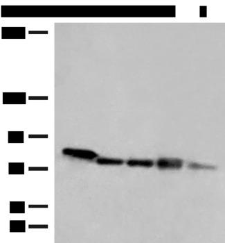 MCCC1 Antibody - Western blot analysis of 293T HepG2 A172 cell Mouse heart tissue Jurkat cell lysates  using MCCC1 Polyclonal Antibody at dilution of 1:300