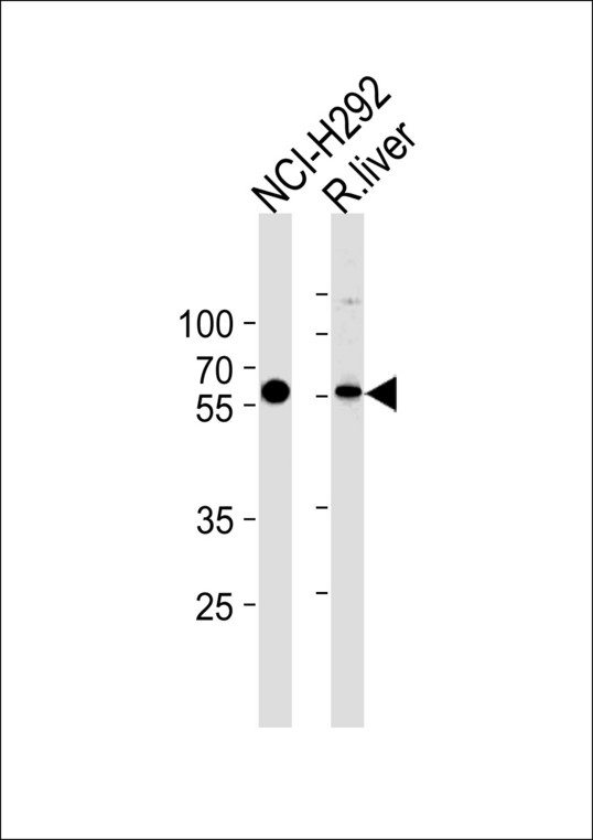 MCCC2 / MCCB Antibody - MCCC2 Antibody western blot of NCI-H292 cell line and rat liver tissue lysates (35 ug/lane). The MCCC2 antibody detected the MCCC2 protein (arrow).