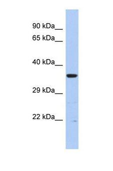 MCCC2 / MCCB Antibody - Western blot of Human PANC1. MCCC2 antibody dilution 1.0 ug/ml.  This image was taken for the unconjugated form of this product. Other forms have not been tested.