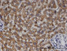 MCCC2 / MCCB Antibody - Immunoperoxidase of monoclonal antibody to MCCC2 on formalin-fixed paraffin-embedded human liver. [antibody concentration 3 ug/ml]