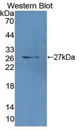 MCCC2 / MCCB Antibody - Western Blot; Sample: Recombinant protein.