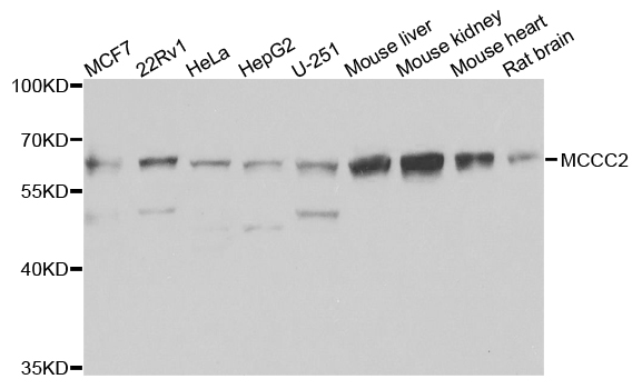 MCCC2 / MCCB Antibody - Western blot analysis of extracts of various cells.