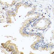 MCCC2 / MCCB Antibody - Immunohistochemistry of paraffin-embedded human prostate.