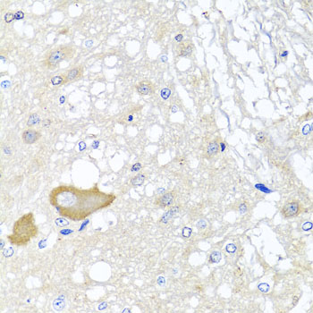 MCCC2 / MCCB Antibody - Immunohistochemistry of paraffin-embedded rat brain tissue.