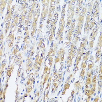 MCCC2 / MCCB Antibody - Immunohistochemistry of paraffin-embedded mouse stomach tissue.
