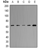 MCCC2 / MCCB Antibody - Western blot analysis of MCCB expression in HeLa (A); HepG2 (B); mouse liver (C); mouse heart (D); rat brain (E) whole cell lysates.