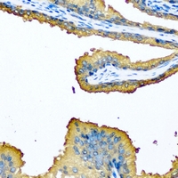 MCCC2 / MCCB Antibody - Immunohistochemical analysis of MCCB staining in human prostate formalin fixed paraffin embedded tissue section. The section was pre-treated using heat mediated antigen retrieval with sodium citrate buffer (pH 6.0). The section was then incubated with the antibody at room temperature and detected using an HRP conjugated compact polymer system. DAB was used as the chromogen. The section was then counterstained with hematoxylin and mounted with DPX.