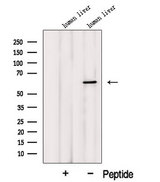 MCCC2 / MCCB Antibody - Western blot analysis of extracts of HeLa cells using MCCC2 antibody. The lane on the left was treated with blocking peptide.