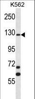 MCF2 / DBL Antibody - MCF2 Antibody western blot of K562 cell line lysates (35 ug/lane). The MCF2 antibody detected the MCF2 protein (arrow).