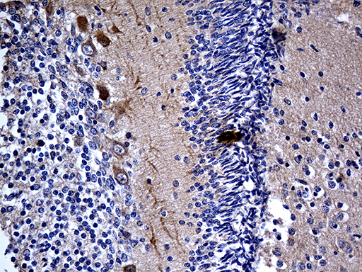 MCF2 / DBL Antibody - Immunohistochemical staining of paraffin-embedded Human embryonic cerebellum within the normal limits using anti-MCF2 mouse monoclonal antibody. (Heat-induced epitope retrieval by 1mM EDTA in 10mM Tris buffer. (pH8.5) at 120 oC for 3 min. (1:500)