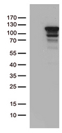 MCF2 / DBL Antibody - HEK293T cells were transfected with the pCMV6-ENTRY control. (Left lane) or pCMV6-ENTRY MCF2. (Right lane) cDNA for 48 hrs and lysed. Equivalent amounts of cell lysates. (5 ug per lane) were separated by SDS-PAGE and immunoblotted with anti-MCF2. (1:500)