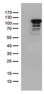 MCF2 / DBL Antibody - HEK293T cells were transfected with the pCMV6-ENTRY control. (Left lane) or pCMV6-ENTRY MCF2. (Right lane) cDNA for 48 hrs and lysed. Equivalent amounts of cell lysates. (5 ug per lane) were separated by SDS-PAGE and immunoblotted with anti-MCF2. (1:500)