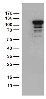 MCF2 / DBL Antibody - HEK293T cells were transfected with the pCMV6-ENTRY control. (Left lane) or pCMV6-ENTRY MCF2. (Right lane) cDNA for 48 hrs and lysed