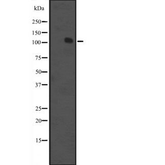 MCF2 / DBL Antibody - Western blot analysis of MCF2 expression in K562 cells line lysate. The lane on the left is treated with the antigen-specific peptide.