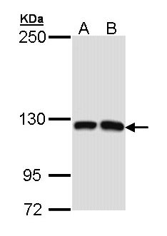 MCF2L / DBS Antibody - Sample (30 ug of whole cell lysate). A: Molt-4 , B: Raji. 5% SDS PAGE. MCF2L / DBS antibody diluted at 1:1000.