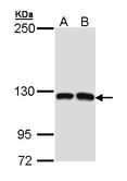 MCF2L / DBS Antibody - Sample (30 ug of whole cell lysate). A: Molt-4 , B: Raji. 5% SDS PAGE. MCF2L / DBS antibody diluted at 1:1000.