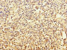 MCF2L / DBS Antibody - Immunohistochemistry of paraffin-embedded human spleen tissue at dilution 1:100