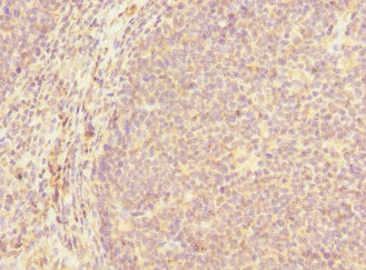 MCF2L / DBS Antibody - Immunohistochemistry of paraffin-embedded human tonsil tissue at dilution 1:100