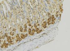 MCF2L / DBS Antibody - 1:100 staining human gastric tissue by IHC-P. The sample was formaldehyde fixed and a heat mediated antigen retrieval step in citrate buffer was performed. The sample was then blocked and incubated with the antibody for 1.5 hours at 22°C. An HRP conjugated goat anti-rabbit antibody was used as the secondary.