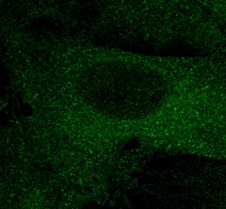 mCherry Antibody - Immunofluorescence - anti-mCherry antibody in COS-7 cells transfected with mCherry-EEA1 at 1:100 dilution. Cells were fixed with 4% of PFA.
