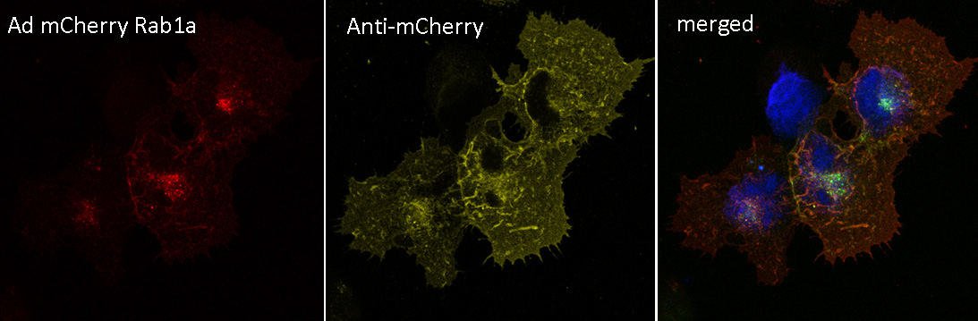 mCherry Antibody - 293 HEK cells transduced with Ad mCherry Rab1a and stained with anti-mCherry