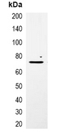 mCherry Tag Antibody - Immunoprecipitation of mCherry-tagged protein from HEK293T cells transfected with vector overexpressing mCherry tag; using Anti-mCherry-tag Antibody.