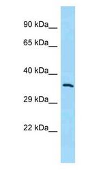 MCHR1 Antibody - MCHR1 antibody Western Blot of 293T.  This image was taken for the unconjugated form of this product. Other forms have not been tested.