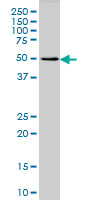 MCHR1 Antibody - GPR24 monoclonal antibody (M01), clone 3D7 Western Blot analysis of GPR24 expression in HL-60.