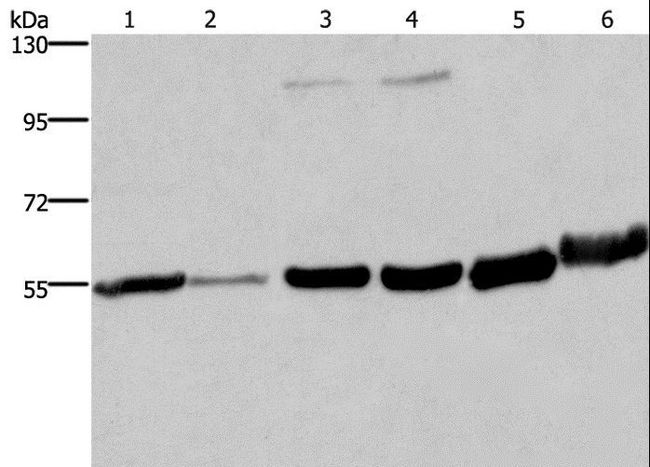 MCHR1 Antibody - Western blot analysis of Human fetal liver and testis tissue, 293T and A172 cell, mouse brain and human fetal brain tissue, using MCHR1 Polyclonal Antibody at dilution of 1:350.