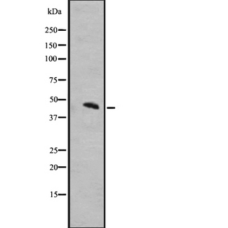 MCHR1 Antibody - Western blot analysis of MCHR1 expression in IMR32 whole cells lysate. The lane on the left is treated with the antigen-specific peptide.