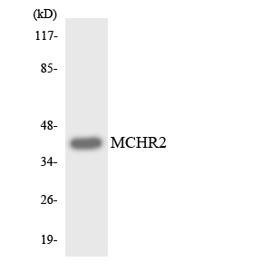 MCHR2 Antibody - Western blot analysis of the lysates from HeLa cells using MCHR2 antibody.