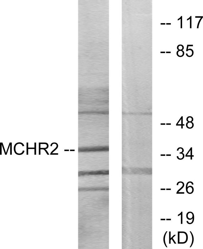 MCHR2 Antibody - Western blot analysis of lysates from HUVEC cells, using MCHR2 Antibody. The lane on the right is blocked with the synthesized peptide.