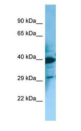 MCHR2 Antibody - MCHR2 antibody Western Blot of Fetal Bladder.  This image was taken for the unconjugated form of this product. Other forms have not been tested.