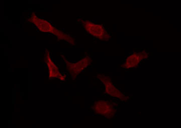 MCHR2 Antibody - Staining HuvEc cells by IF/ICC. The samples were fixed with PFA and permeabilized in 0.1% Triton X-100, then blocked in 10% serum for 45 min at 25°C. The primary antibody was diluted at 1:200 and incubated with the sample for 1 hour at 37°C. An Alexa Fluor 594 conjugated goat anti-rabbit IgG (H+L) Ab, diluted at 1/600, was used as the secondary antibody.