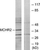 MCHR2 Antibody - Western blot analysis of extracts from HUVEC cells, using MCHR2 antibody.