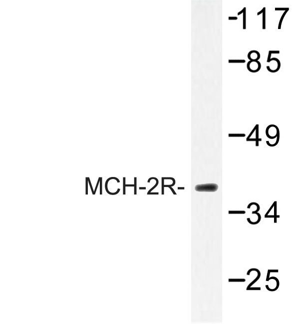 MCHR2 Antibody - Western blot of MCH-2R (M332) pAb in extracts from HUVEC cells.