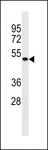 MCIDAS / MCIN Antibody - IDAS Antibody western blot of human uterus tissue lysate (35 ug/lane). The IDAS antibody detected the IDAS protein (arrow).