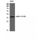 MCL1 / MCL 1 Antibody - Western blot of Phospho-Mcl-1 (S159) antibody
